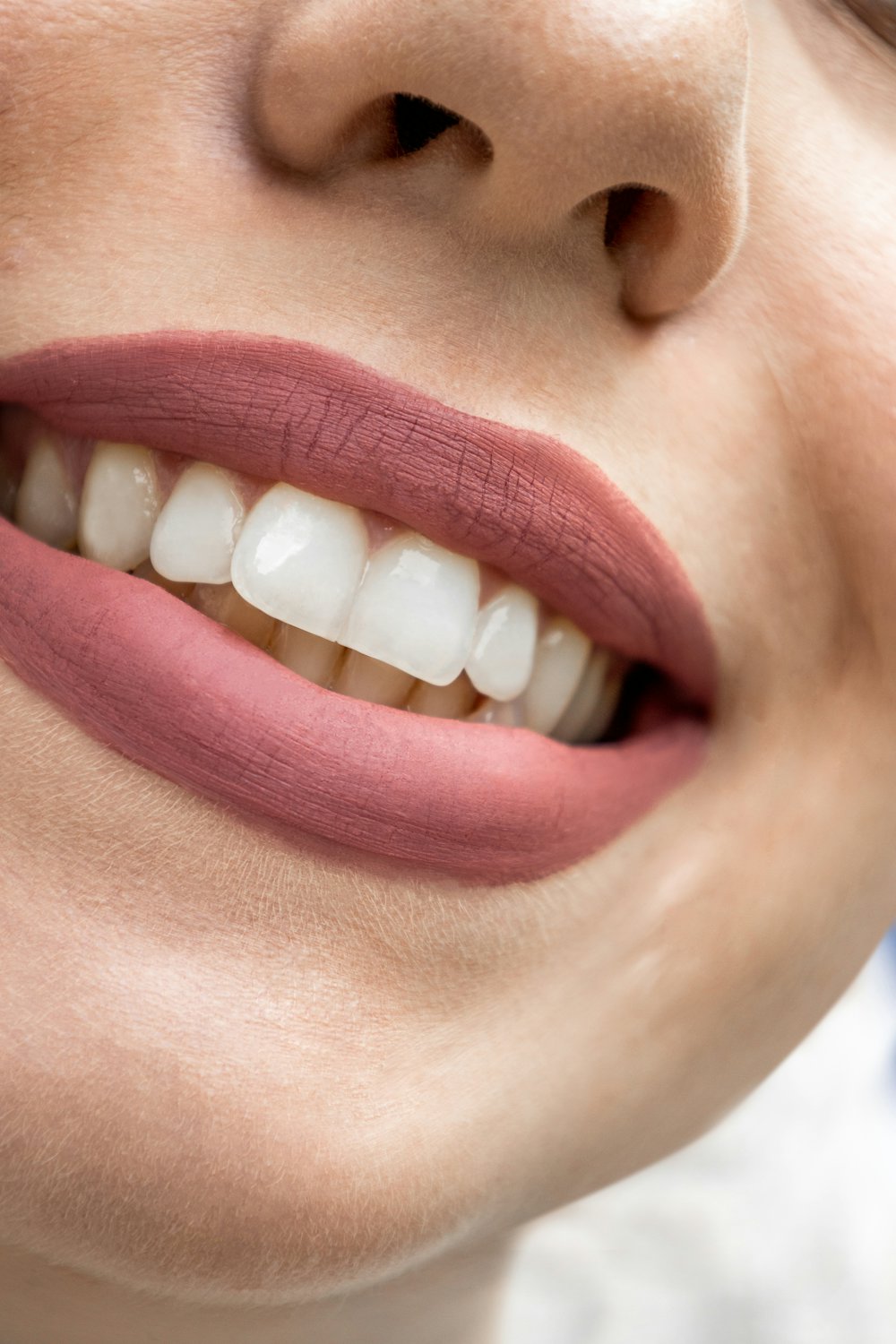 Close-up of a straight, even smile after orthodontic treatment